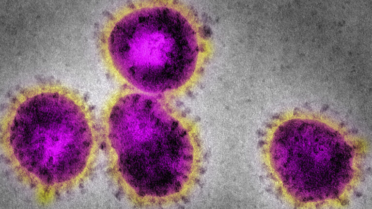 EM Coronavirus, causing SARS