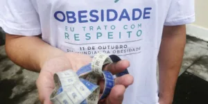 Jovem a partir dos 14 anos passa a poder fazer cirurgia bariátrica