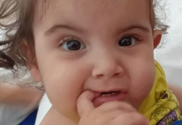 Morre Kiraz, uma das irmãs siamesas separadas em cirurgia inédita realizada em Goiás