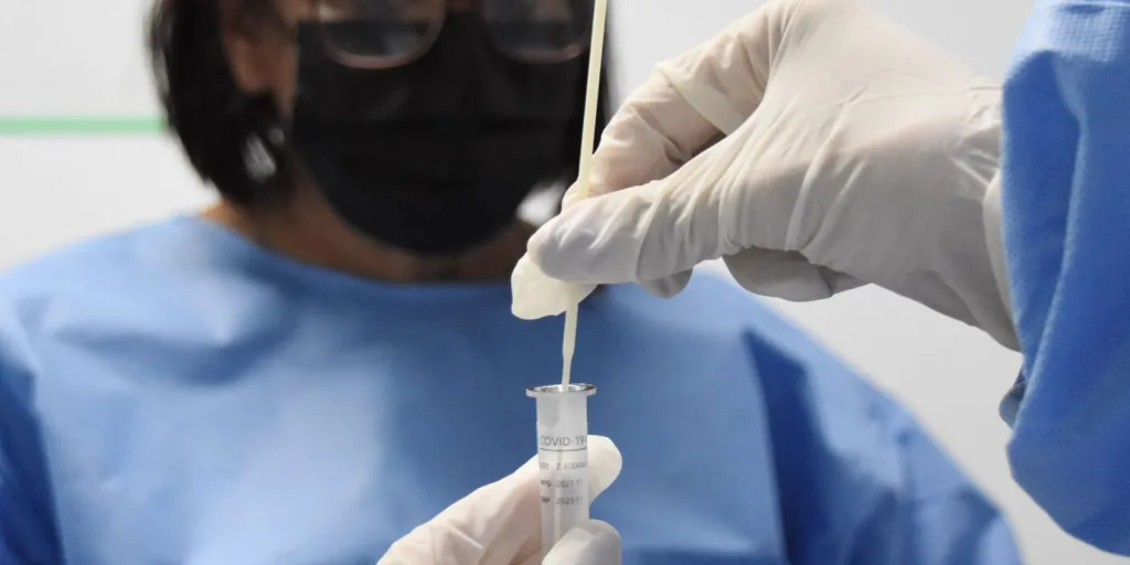 RJ: cenário epidemiológico de covid-19 tem tendência de redução