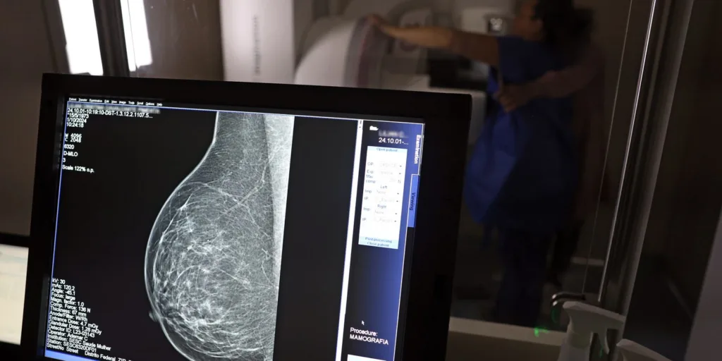 Ministério da Saúde passa a recomendar mamografia a partir dos 40 anos