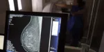 Entidades médicas divulgam guia para evitar negativas em pedidos de mamografia digital