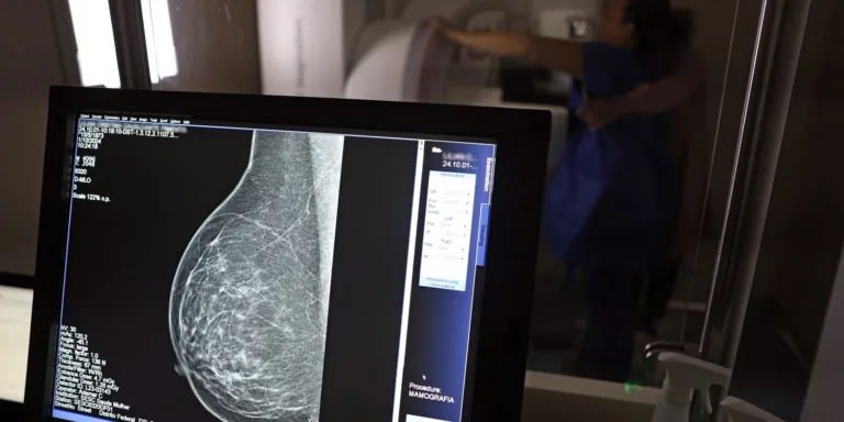 Ministério da Saúde passa a recomendar mamografia a partir dos 40 anos