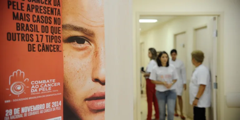 Casos de câncer de pele saltam de 4 mil para mais de 72 mil em 10 anos