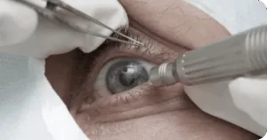 Juíza determina fornecimento de medicamento de alto custo após reconhecer risco iminente de cegueira