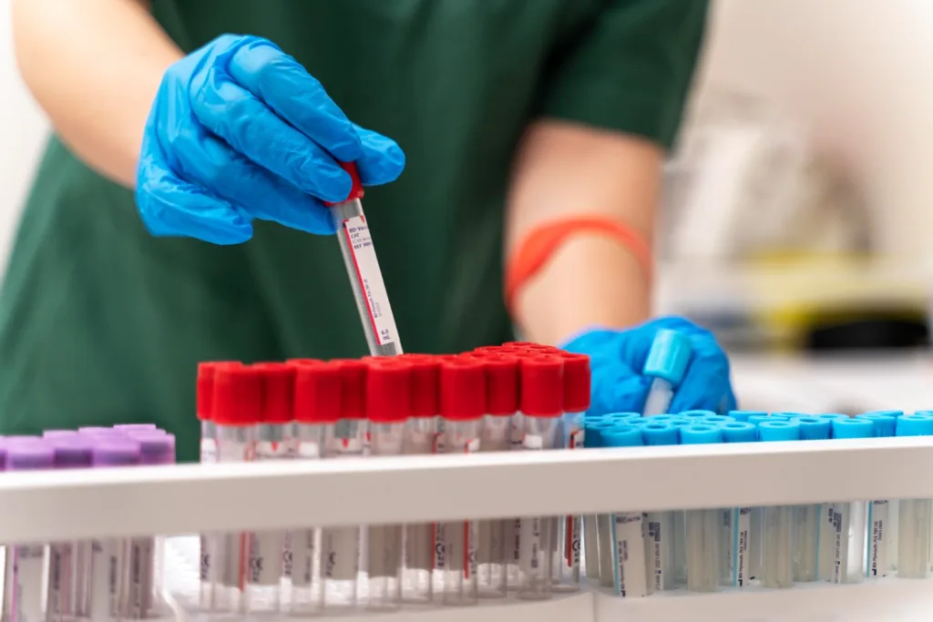 Prefeitura oferta exames laboratoriais em unidades básicas de saúde abertas aos sábados