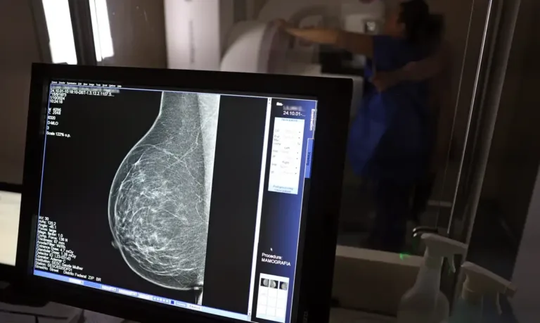 Plano de saúde terá que cobrir mamografia digital para todas as idades a partir de outubro